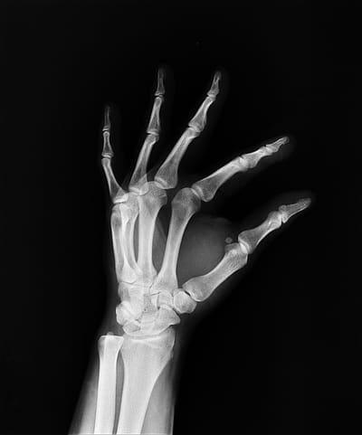 O NAS image